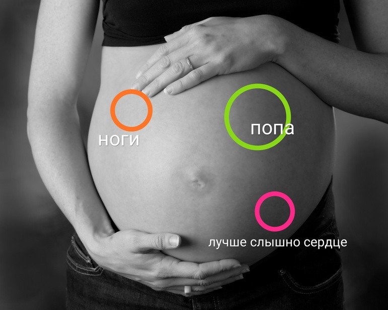 Геморрой при беременности: признаки, симптомы, лечение, чем опасен, как избежать