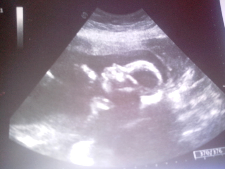 и у нас ..... мальчик!!!