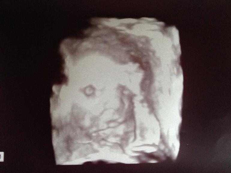 УЗИ - 27 неделя=)