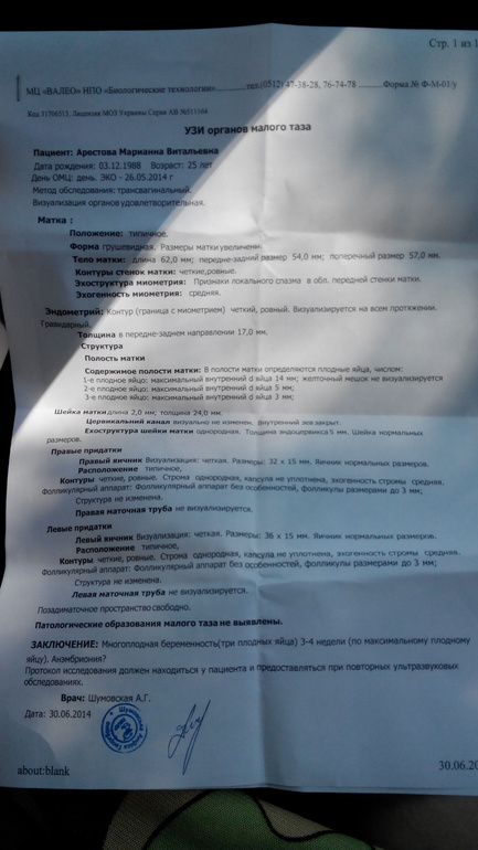 все конец 35дпп??