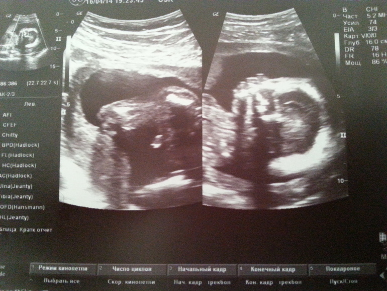 Тайна раскрыта))))))))))