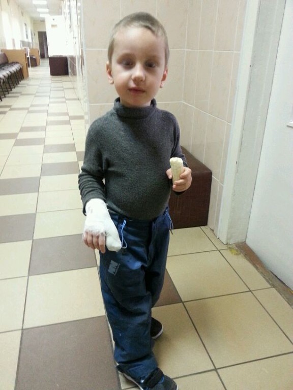 Наш зайчик сломал пальчик (((
