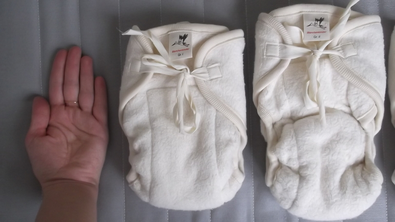 Storchenkinder: сравнительный обзор.