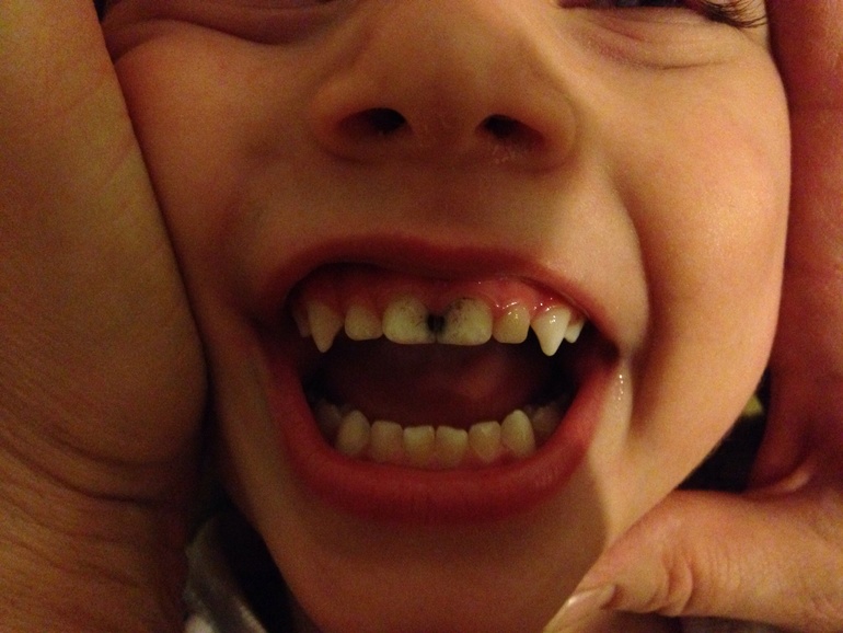 Нужен Ваш совет, очень!!