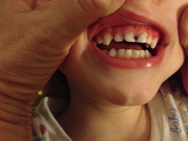 Нужен Ваш совет, очень!!