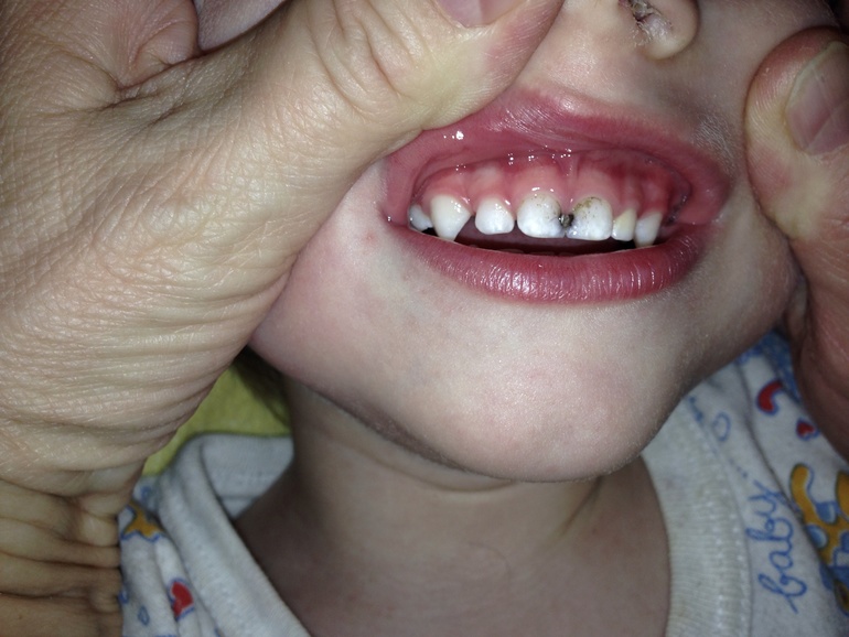 Нужен Ваш совет, очень!!