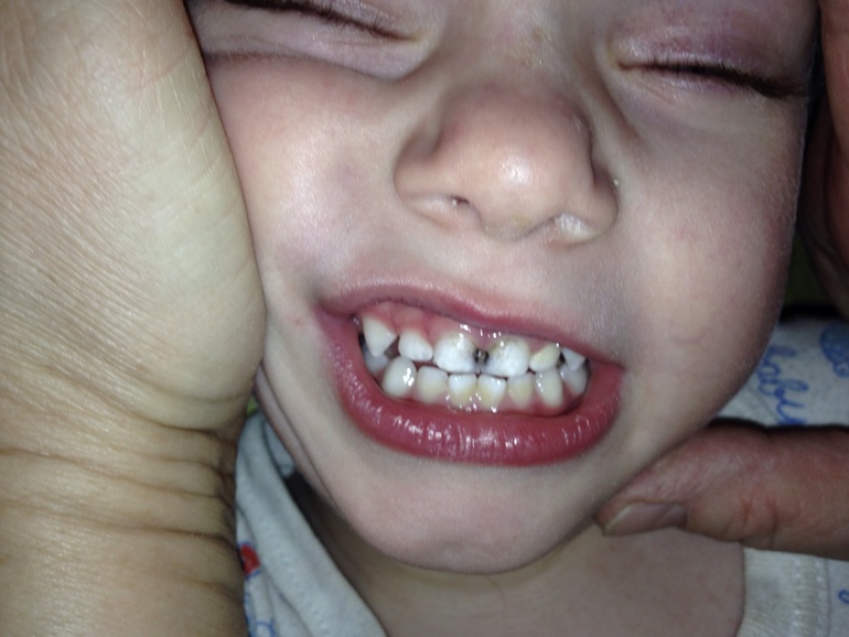 Нужен Ваш совет, очень!!