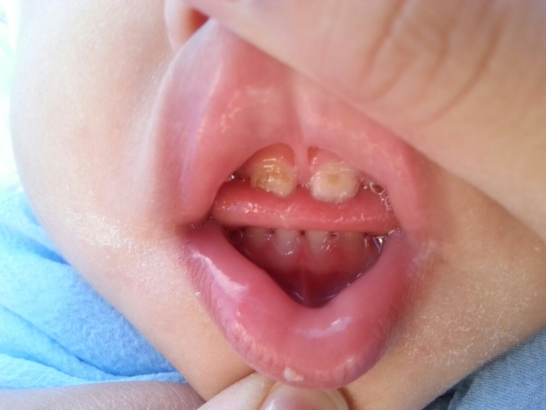 Нуждаемся в совете!!!