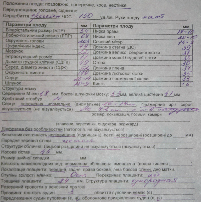 Короткая носовая косточка, стоит ли беспокоится?