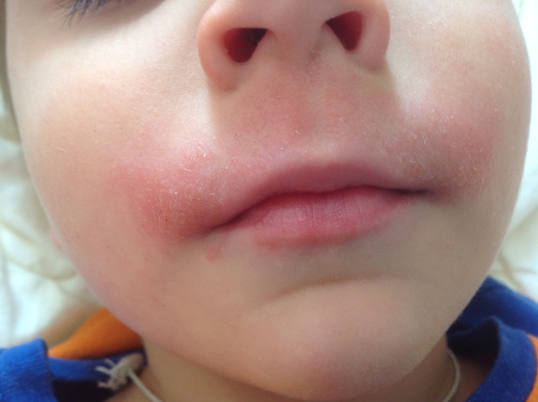 Шершавый рот