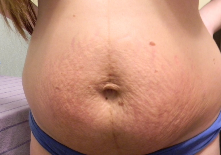 Я и мои растяжки!