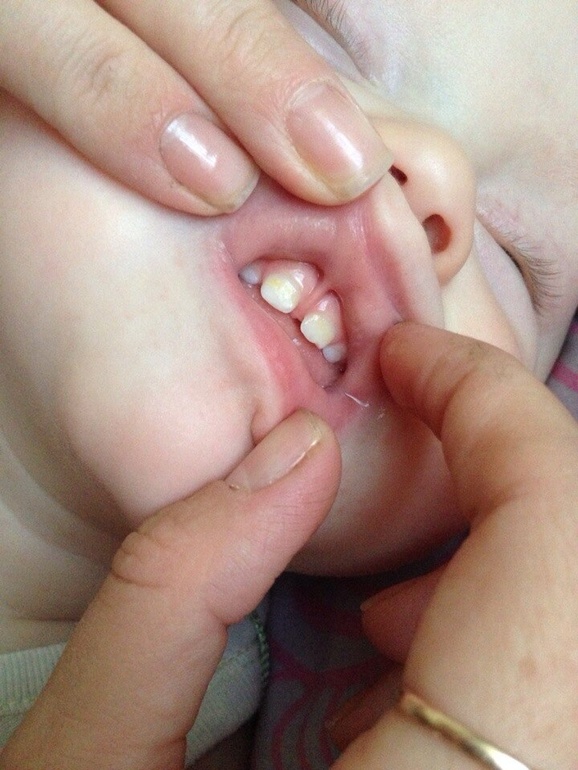 Подскажите пожалуйста!!!