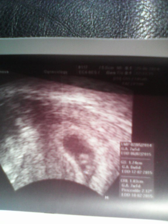 Уже на человечка похож