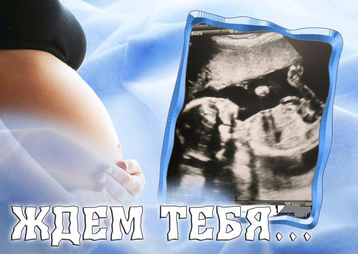 узи  нам 19-20 недель