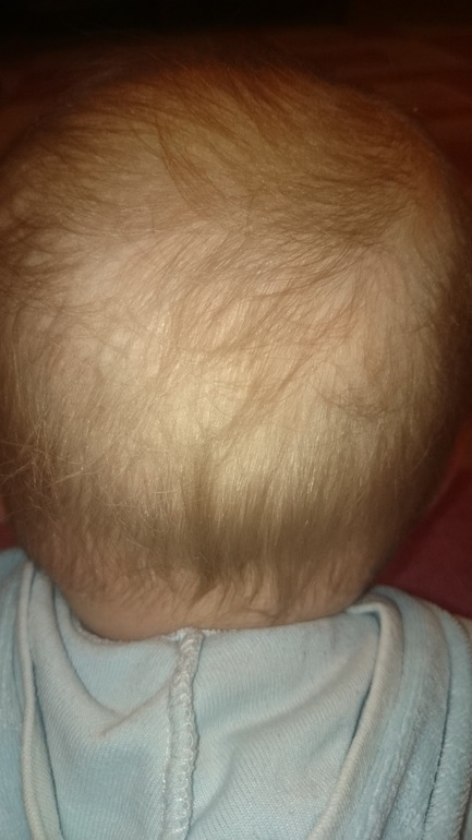 Что делать если у ребенка плохо растут волосы на голове в 4 года