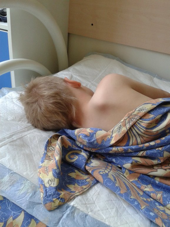 Прощайте аденоиды