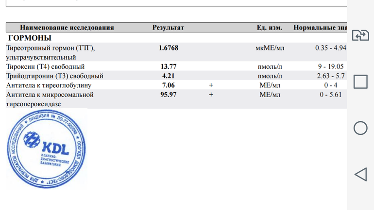 Кдл сайт результаты анализов. КДЛ антитела к коронавирусу. Результат антител к ТТГ. КДЛ результат анализа ПЦР. Результат анализа на антитела КДЛ.