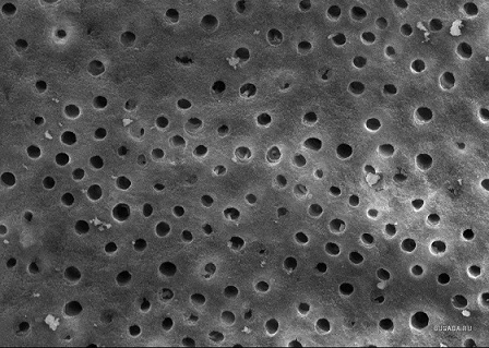 Почему зуб болит?