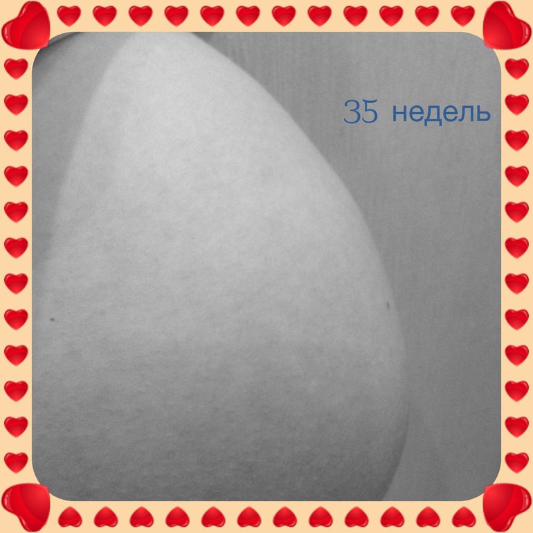 35 недель:)))))