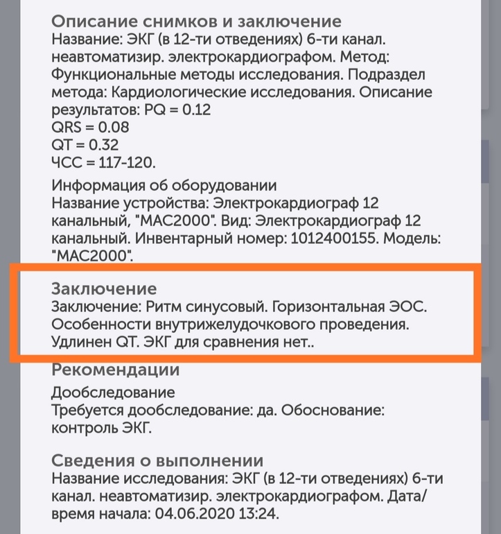 Заключение экг. Заключение по ЭКГ. Заключение ЭКГ пример. ЭКГ заключение норма. Заключение ЭКГ ЭОС.