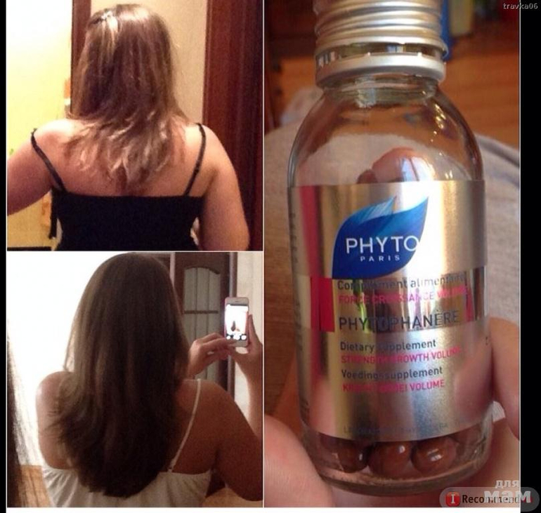 Посоветуйте витамины для секущихся волос