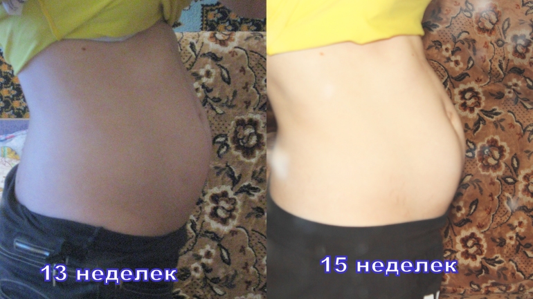 началась 16-тая неделька