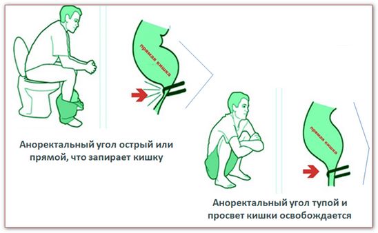 Поза орла при запоре картинки