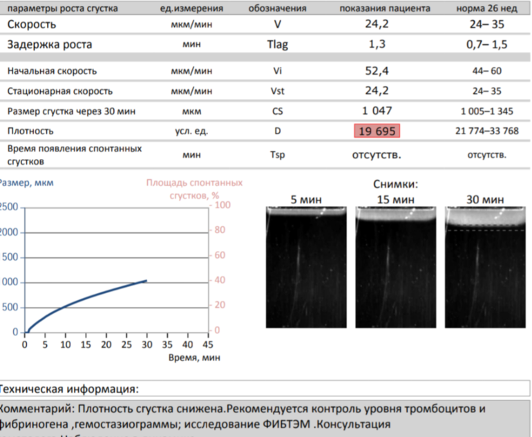 Тромбодинамика инвитро. Анализ Тромбодинамика при беременности. Нормы исследования тромбодинамики. Тромбодинамика исследование. Тромбодинамика норма при беременности.
