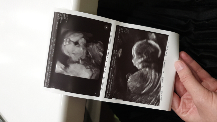 20 недель + 1 день❤ пол узнаем чуть позже. Будет сюрприз