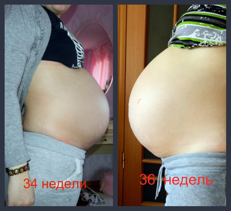 35 недель беременности каменеет