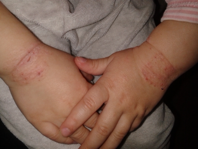 а может это не аллергия?...