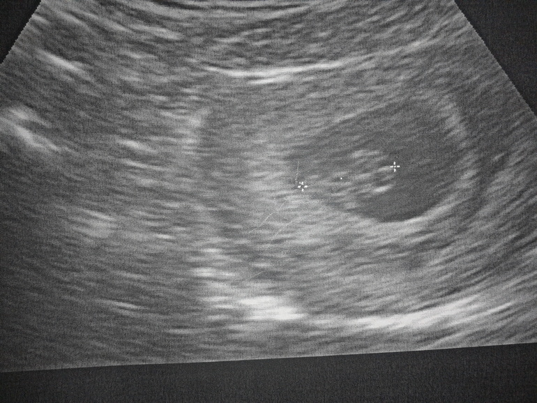 мы познакомились с нашим малышом))))