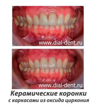 7754573d6f9361b0421abd82ee60b92b.jpg
