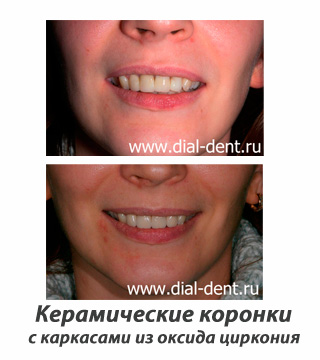88ecf545ba88a112b10e0089d5bdc8f3.jpg