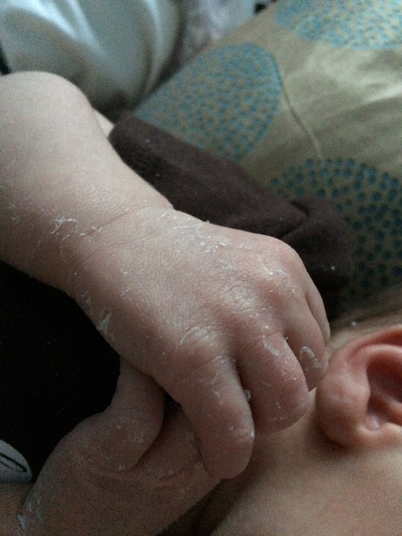 Cухая кожа у ребенка - причины и как с этим бороться | Бепантен®