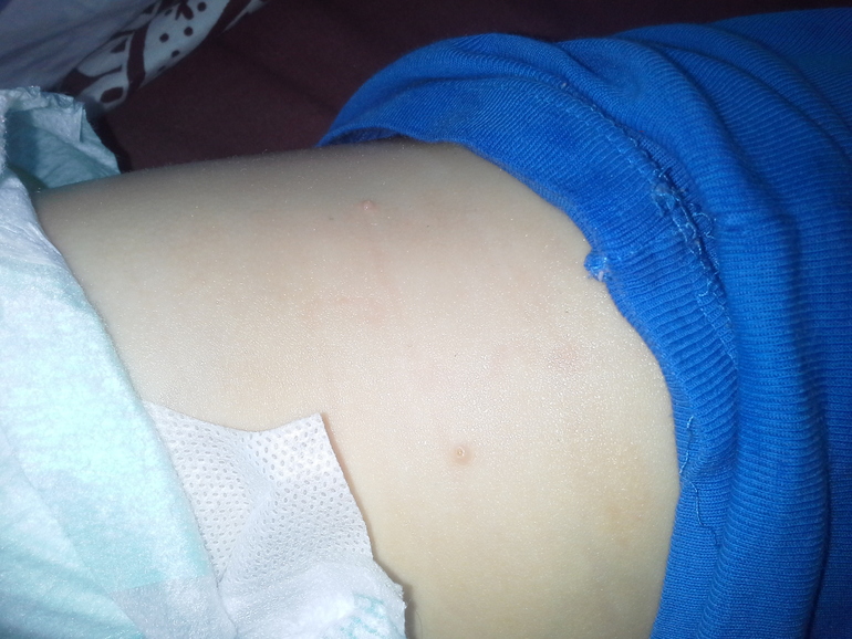 что это за пупырышки?