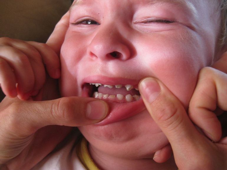Лечить ли под наркозом Севоран или ждать, когда подрастет.