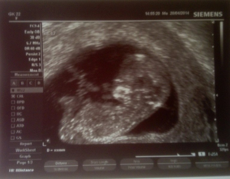 Полет дирижаблика, двенадцатая неделя