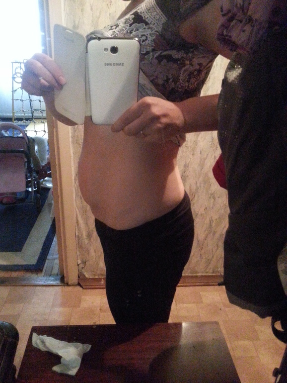 живот после родов.