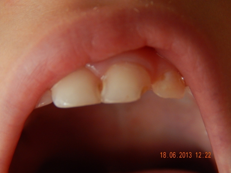 и мы на консультацию...