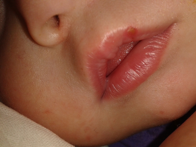 девочки! !!!что это?