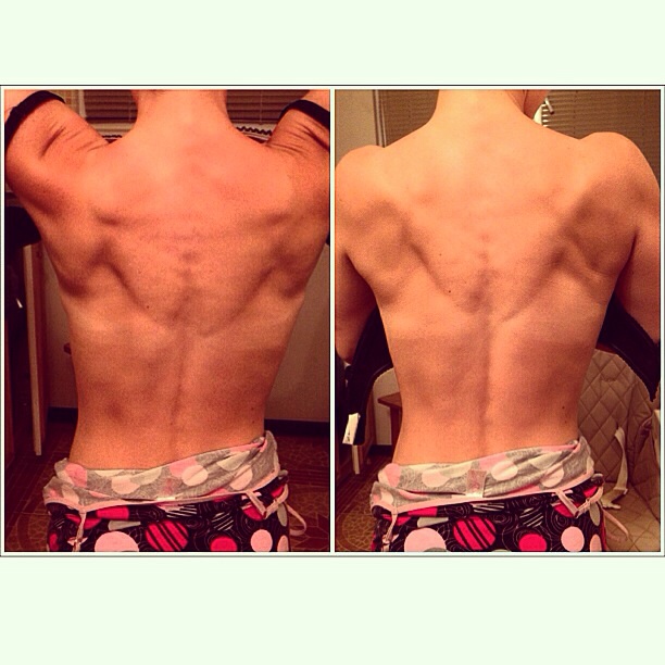 Спинка моя меня шокировала!