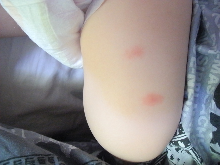 Комары или нет?