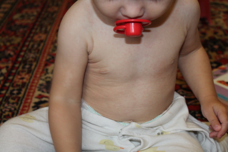 Доктор Л. Третье посещение