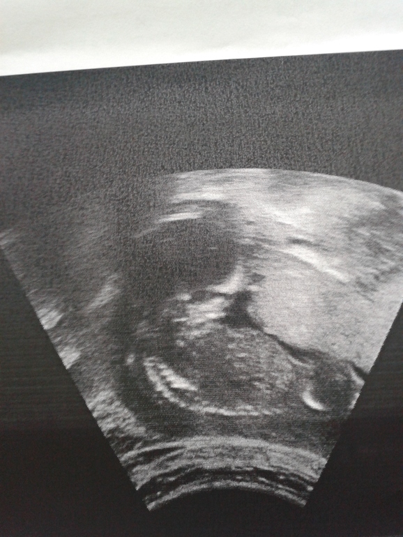 экватор и вопросы по узи