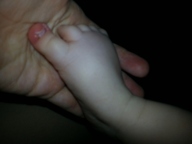 красные большие пальчики на ножках