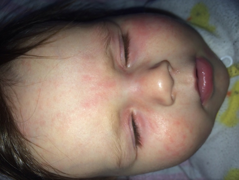 Что с нашей мосей!)