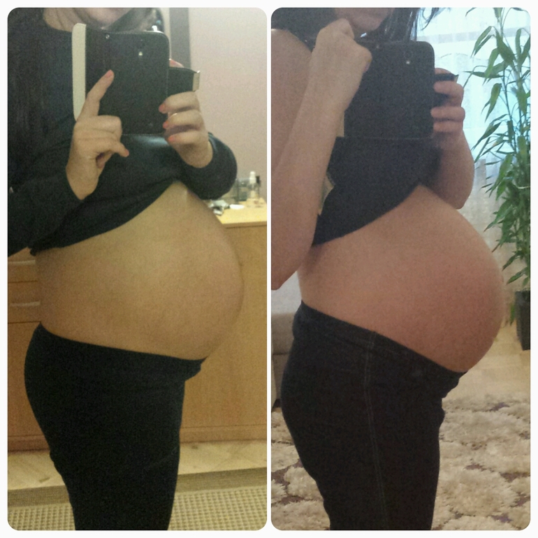 38 недель опустился живот. Опущенный живот при беременности. Опущение живота у первородящих. Опущенный живот при беременности до и после. Как выглядит опущенный живот.