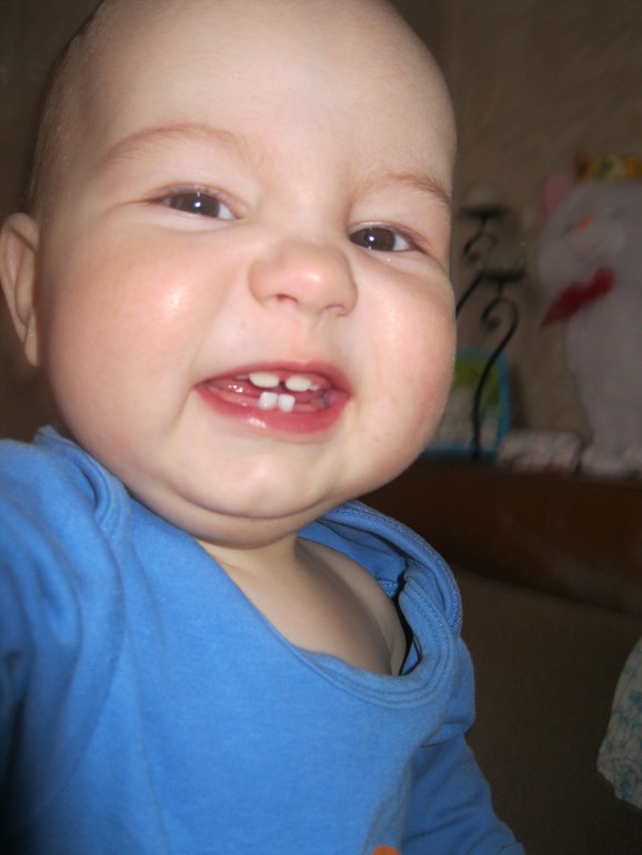 Сабаев Богданчик. Диагноз: Высокая легочная гипертензия. Срочно нужно лечение в Германии!!!