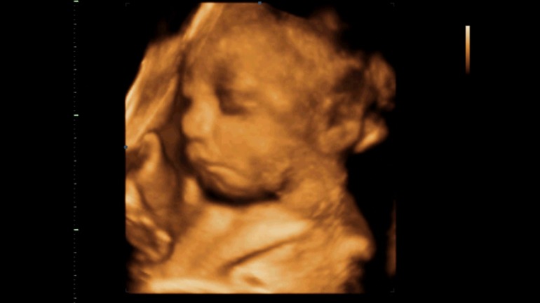 Узи, 31 неделя и 1 день.